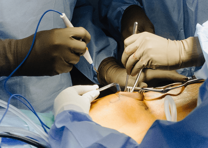 Cirugía de rodilla - Traumatólogo y Ortopedista