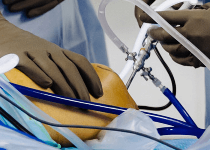 Cirugía de rodilla - Traumatólogo y Ortopedista